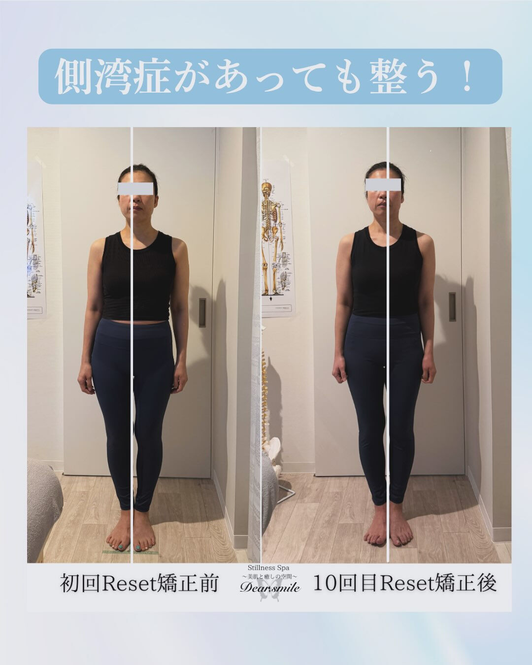 #茂原フェイシャル#茂原肌管理#肌管理#姿勢改善#冨田勝re